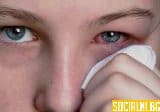 Ечемик на окото – защо се появява, как се лекува и как да се предпазим